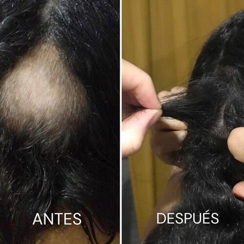 Combo Integral Crecepel – Tratamiento Anticaída y Crecimiento Capilar - SAYII