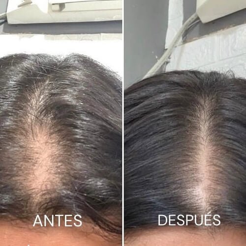 Kit Crecepel - Anticaída y Crecimiento - SAYII